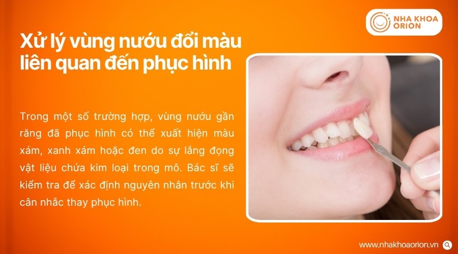 Phục hình phù hợp có thể được cân nhắc khi vùng nướu đổi màu liên quan đến vật liệu của phục hình