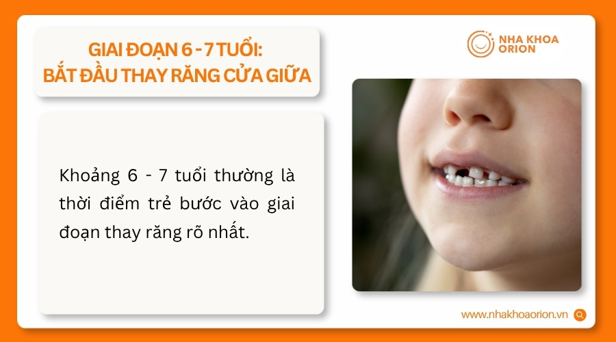 Trẻ 6 - 7 tuổi thường thay răng cửa giữa v&agrave; bắt đầu mọc răng số 6 vĩnh viễn