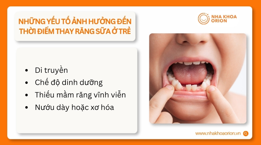 Di truyền, dinh dưỡng, mầm răng v&agrave; t&igrave;nh trạng nướu c&oacute; thể ảnh hưởng thời điểm thay răng