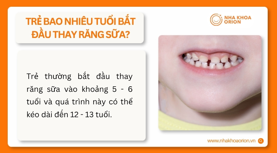 Trẻ thường bắt đầu thay răng sữa từ 5 - 6 tuổi v&agrave; ho&agrave;n tất khoảng 12 - 13 tuổi