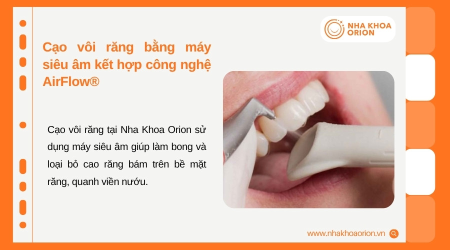 Orion kết hợp m&aacute;y si&ecirc;u &acirc;m v&agrave; AirFlow&reg; để hỗ trợ l&agrave;m sạch cao răng, mảng b&aacute;m v&agrave; vết ố