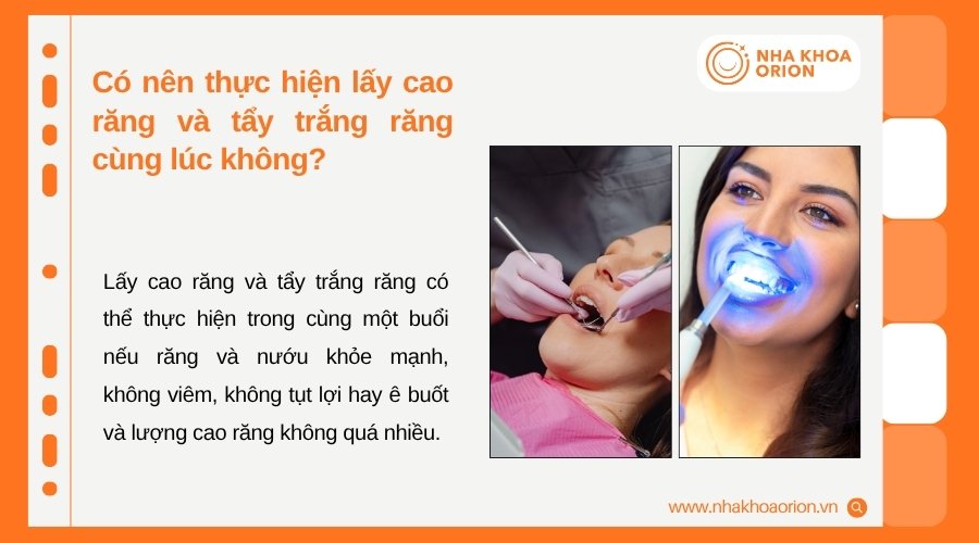 Lấy cao răng v&agrave; tẩy trắng c&oacute; thể thực hiện c&ugrave;ng buổi khi răng nướu đủ khỏe mạnh