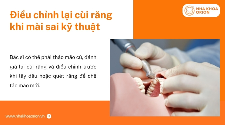 B&aacute;c sĩ c&oacute; thể điều chỉnh m&atilde;o sứ v&agrave; khớp cắn khi t&igrave;nh trạng cộm ở mức nhẹ