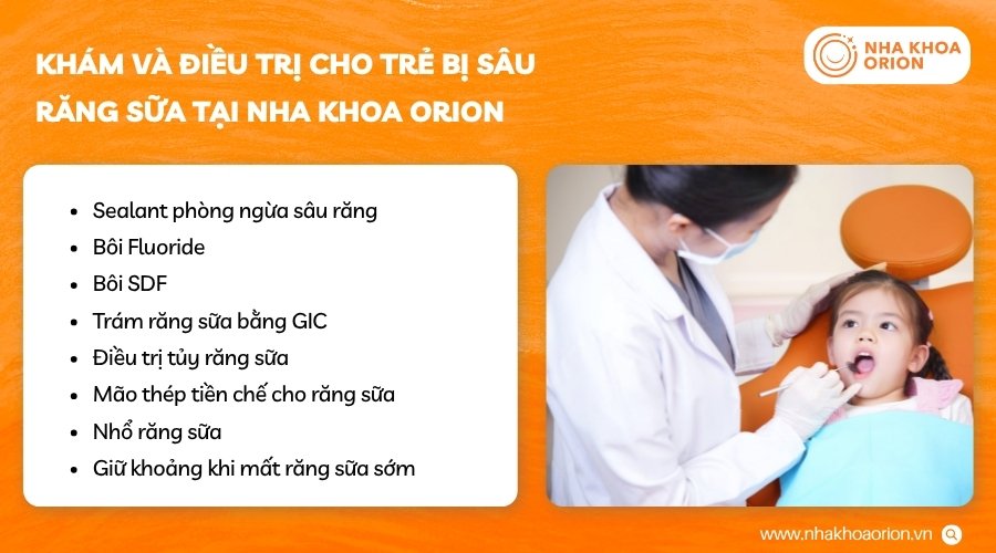 Orion cung cấp đa dạng các dịch vụ chăm sóc răng miệng cho trẻ em
