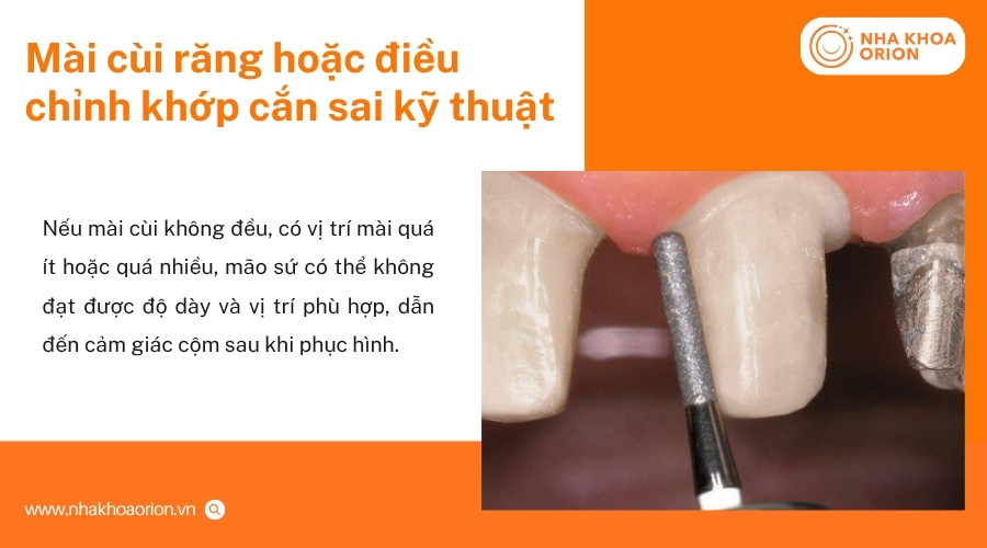 M&agrave;i c&ugrave;i hoặc điều chỉnh khớp cắn sai kỹ thuật c&oacute; thể khiến m&atilde;o sứ bị cộm