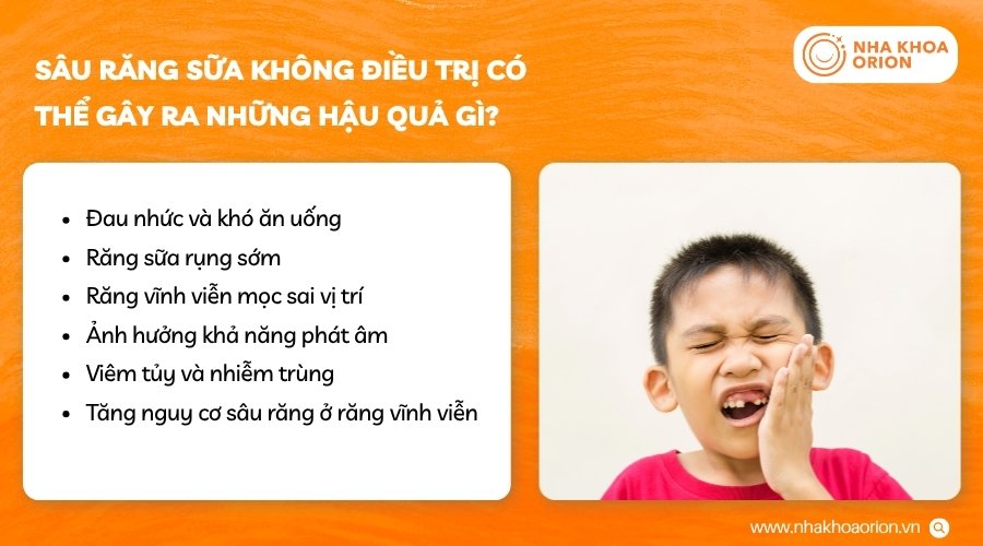Sâu răng sữa kéo dài có thể gây nhiều ảnh hưởng đến trẻ