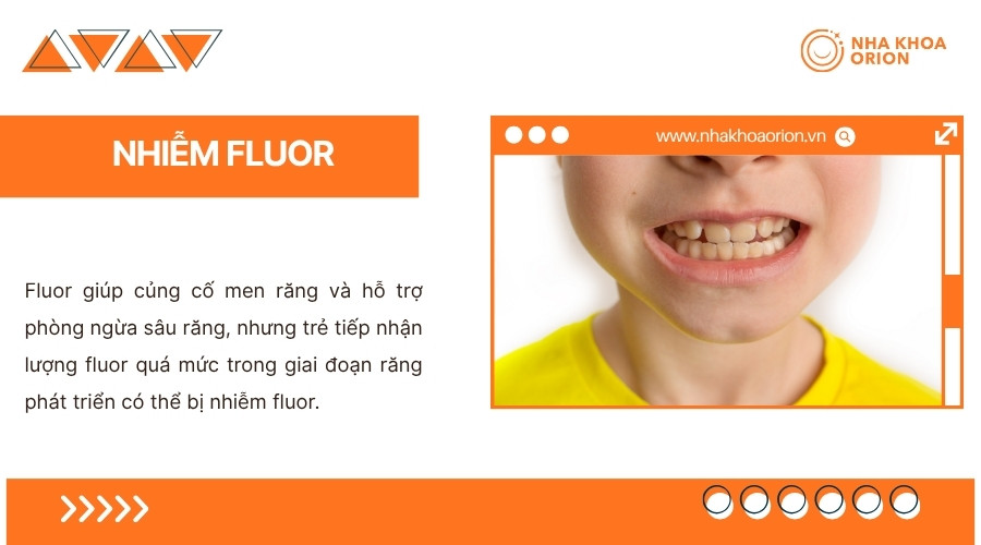 Trẻ tiếp nhận qu&aacute; nhiều fluor trong giai đoạn ph&aacute;t triển răng c&oacute; thể bị nhiễm fluor