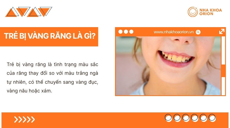 M&agrave;u răng của trẻ c&oacute; thể thay đổi do nhiều biểu hiện kh&aacute;c nhau