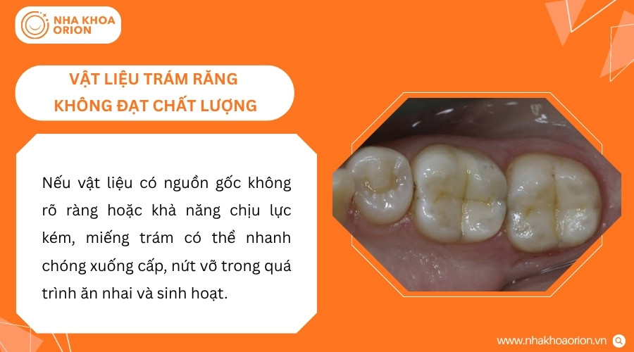 Vật liệu kém chất lượng có thể làm giảm độ bền và khả năng chịu lực của miếng trám
