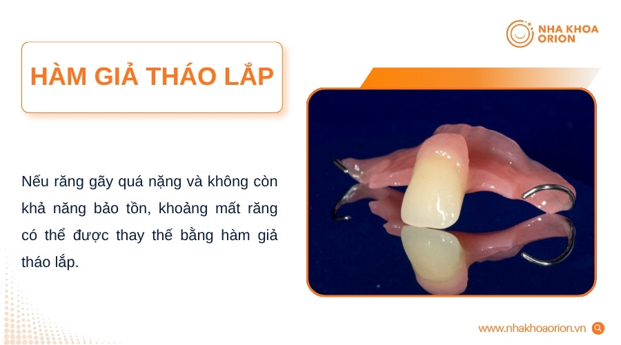 Hàm giả tháo lắp giúp lấp khoảng mất răng và hỗ trợ ăn nhai