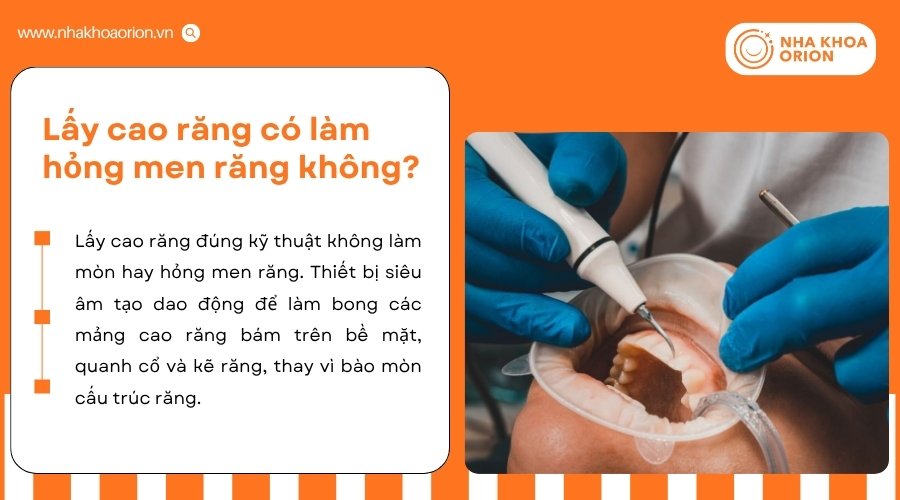 Lấy cao răng đ&uacute;ng kỹ thuật gi&uacute;p loại bỏ cao răng m&agrave; kh&ocirc;ng g&acirc;y tổn thương men răng