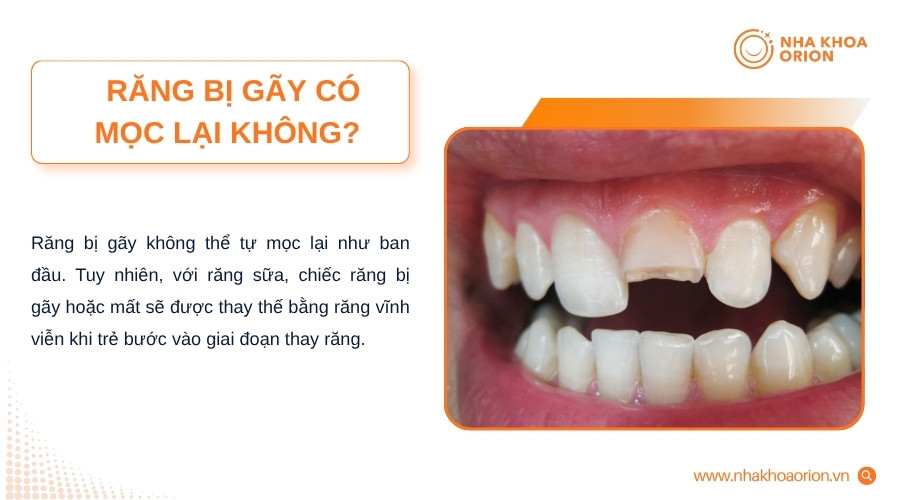 Răng bị gãy không thể tự mọc lại như ban đầu