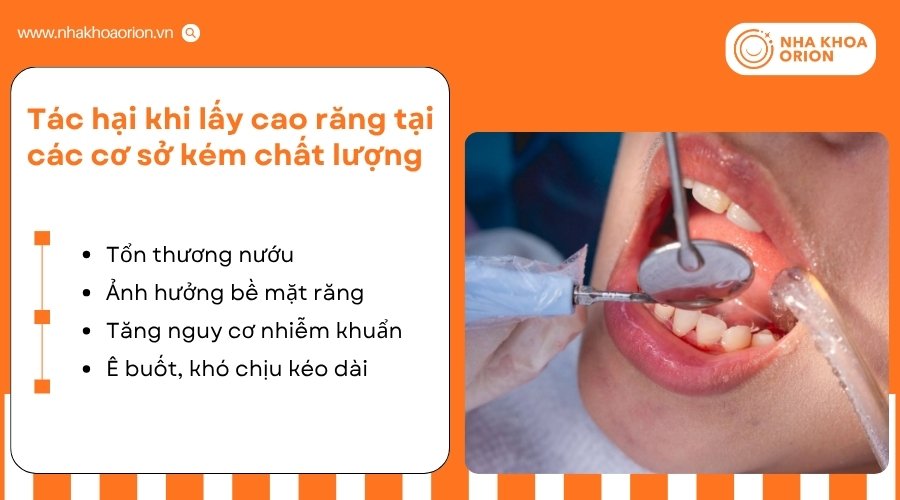 Cơ sở k&eacute;m chất lượng c&oacute; thể l&agrave;m tăng nguy cơ tổn thương răng v&agrave; nướu khi lấy cao răng