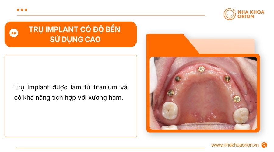 Implant c&oacute; thể duy tr&igrave; trong thời gian d&agrave;i khi được chăm s&oacute;c v&agrave; t&aacute;i kh&aacute;m đ&uacute;ng c&aacute;ch